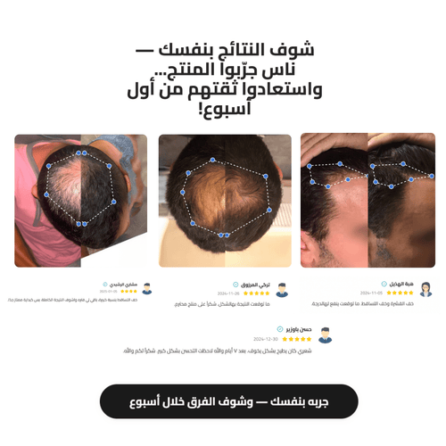 سيروم رول-أون لنمو الشعر من الجسم